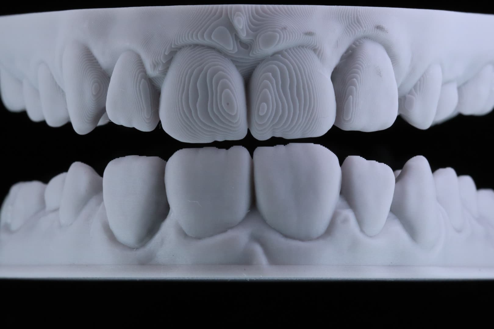 Figure 5: Ackuretta Curo Ortho Model – models printed orientated horizontally and vertically – note the difference in layer line formation