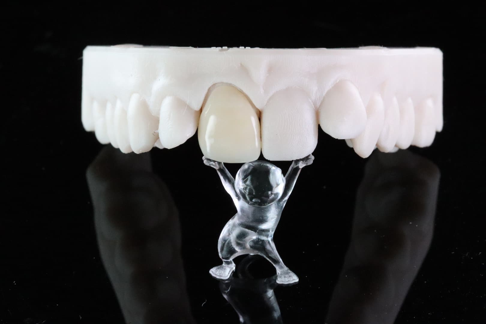 Figure 5: Bego TriniQ veneer printed at 100 micron layers on the Asiga Max UV