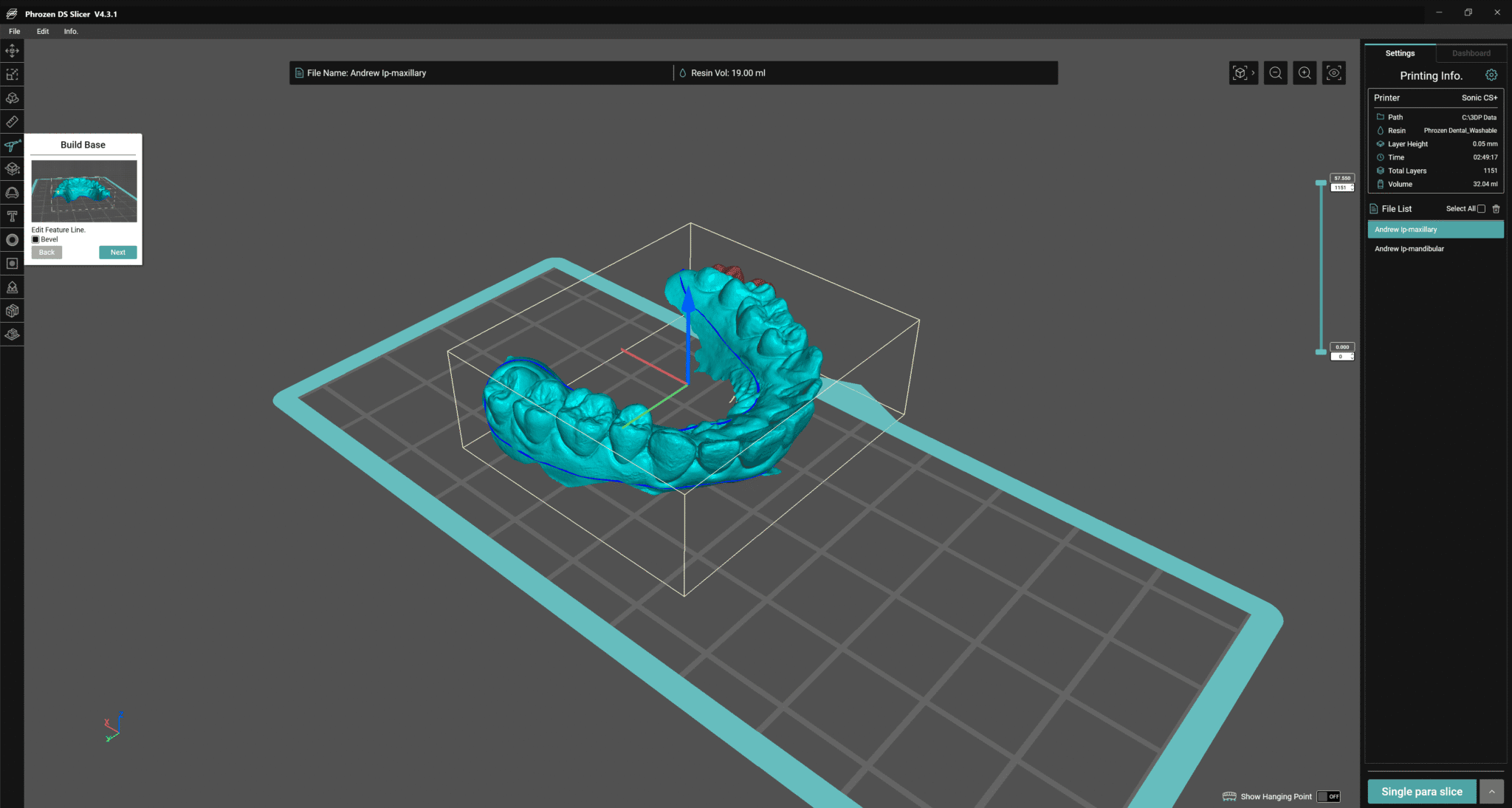 Figure 4: Don’t underestimate Phrozen DS Slicer – it has kickass scan-to-model capabilities that make even the high-end dental 3D printer slicers blush