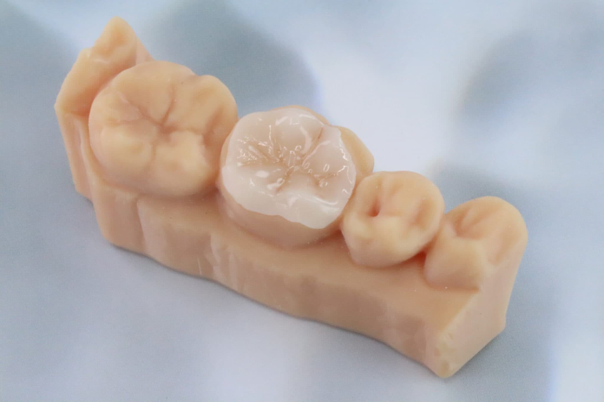 Figure 7: The CS+ is overall a strong contender in the professional dental market