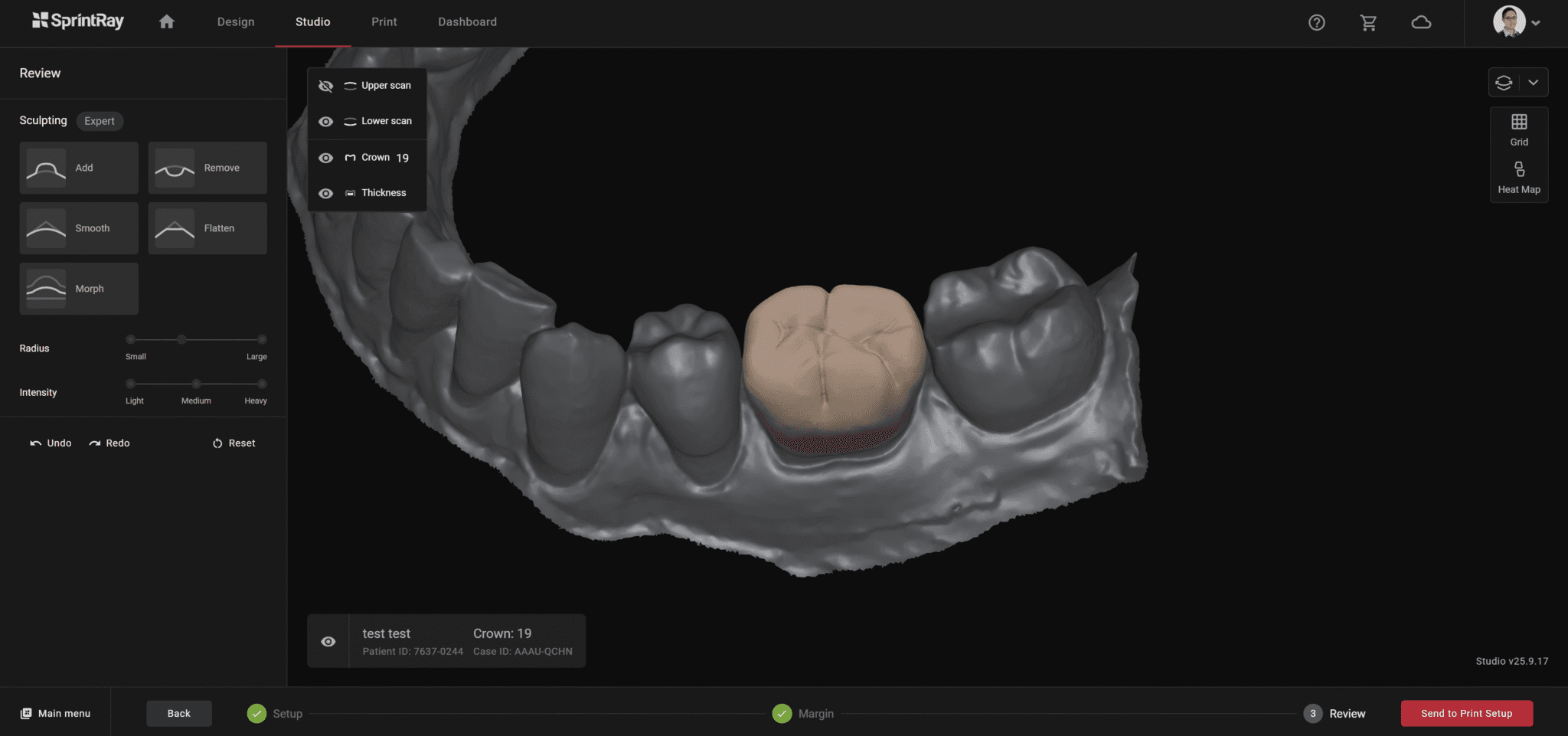 Figure 6: Sprintray Studio still needs some improvement to be completely accessible for the novice user