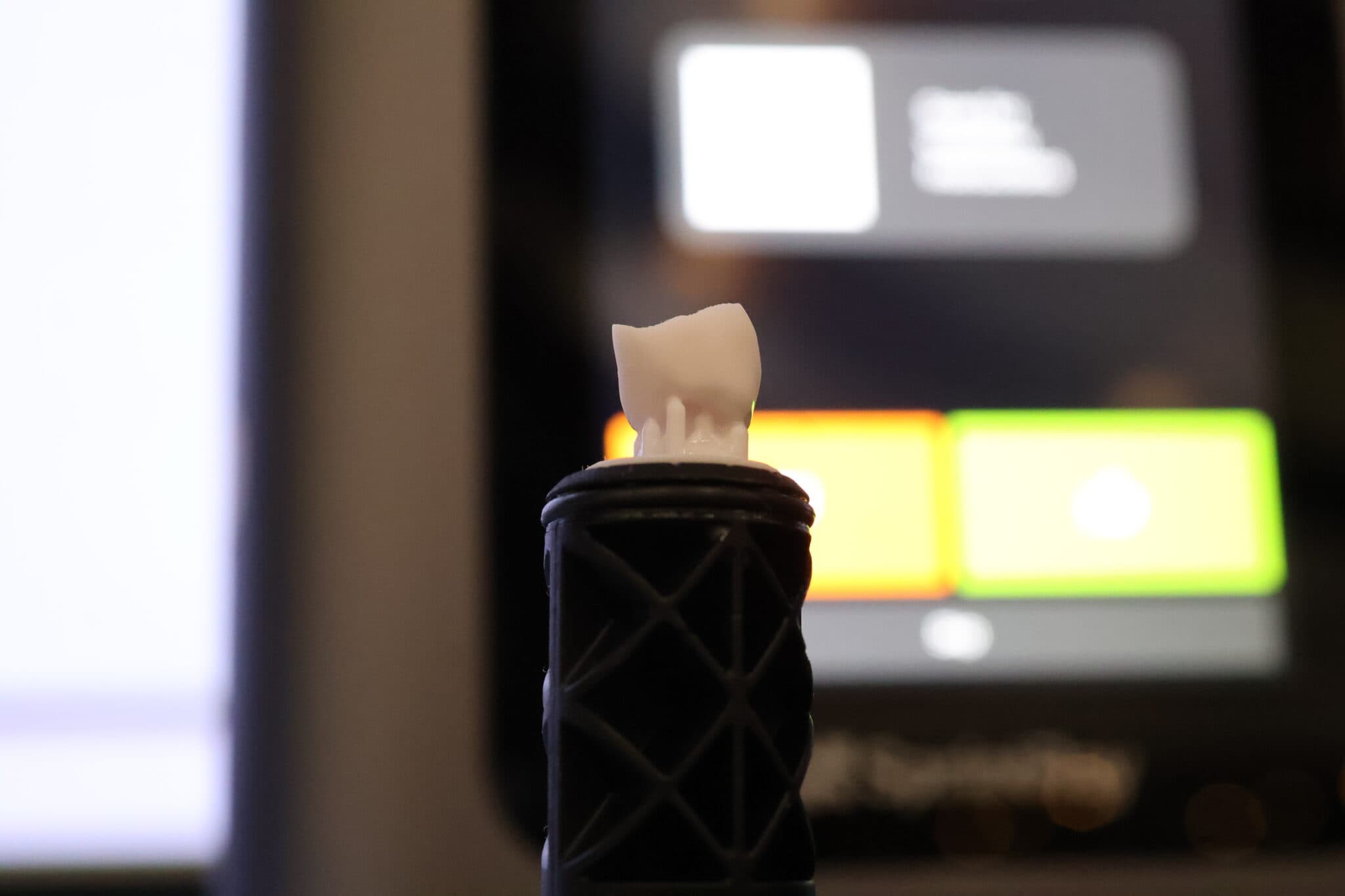 Figure 7: Investing in the Midas is akin to investing in the future of 3D printed restorations – and I think the future is bright!