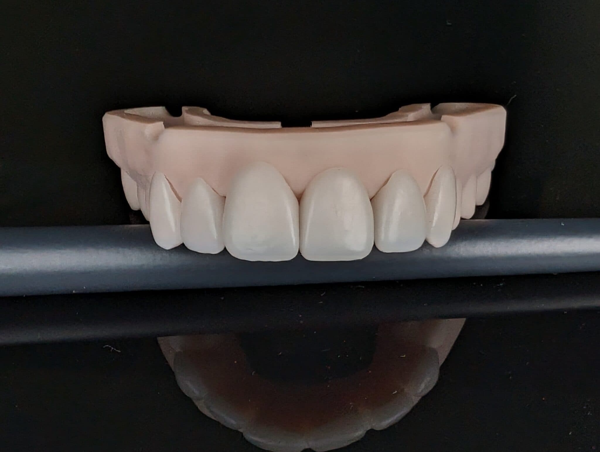 Figure 3: OnX Tough 2 veneers on Sprintray Model Stone