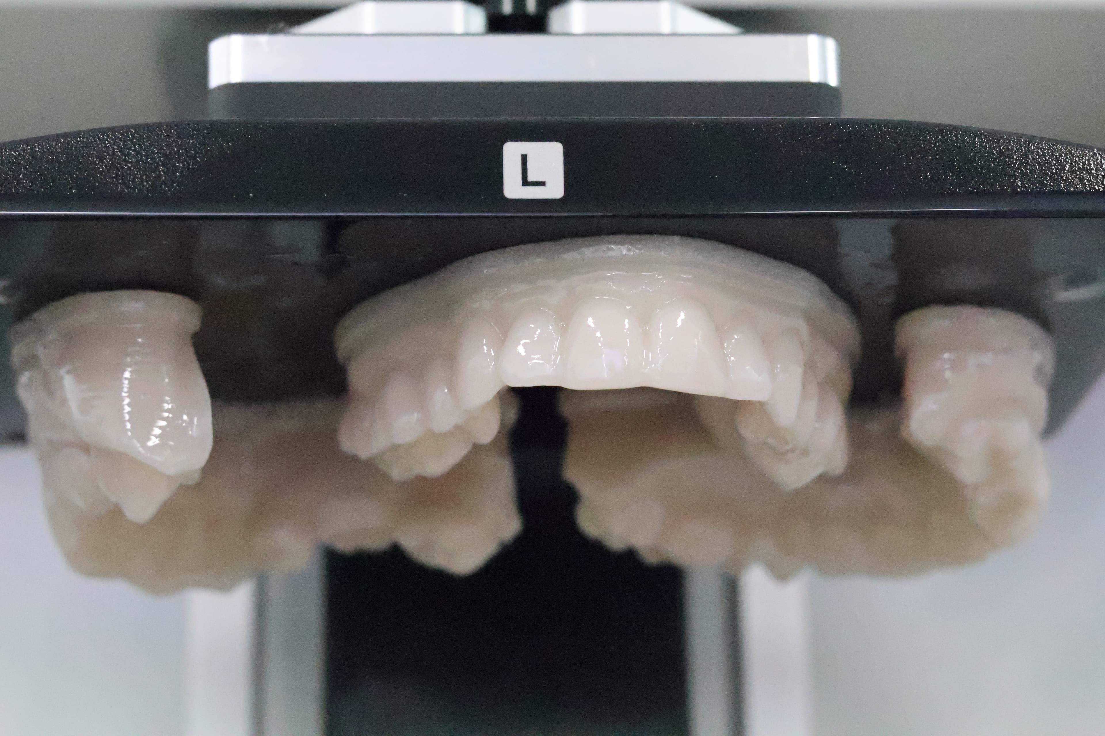 TruModel prints quickly and well on the Ackuretta SOL SE