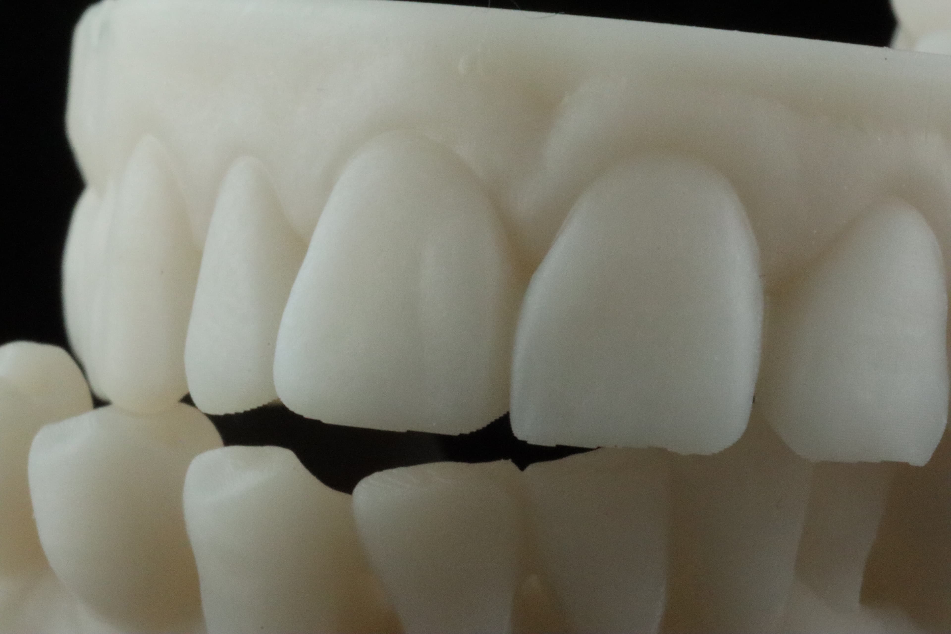 Great detail depiction with TruModel (printed @ 100 microns)