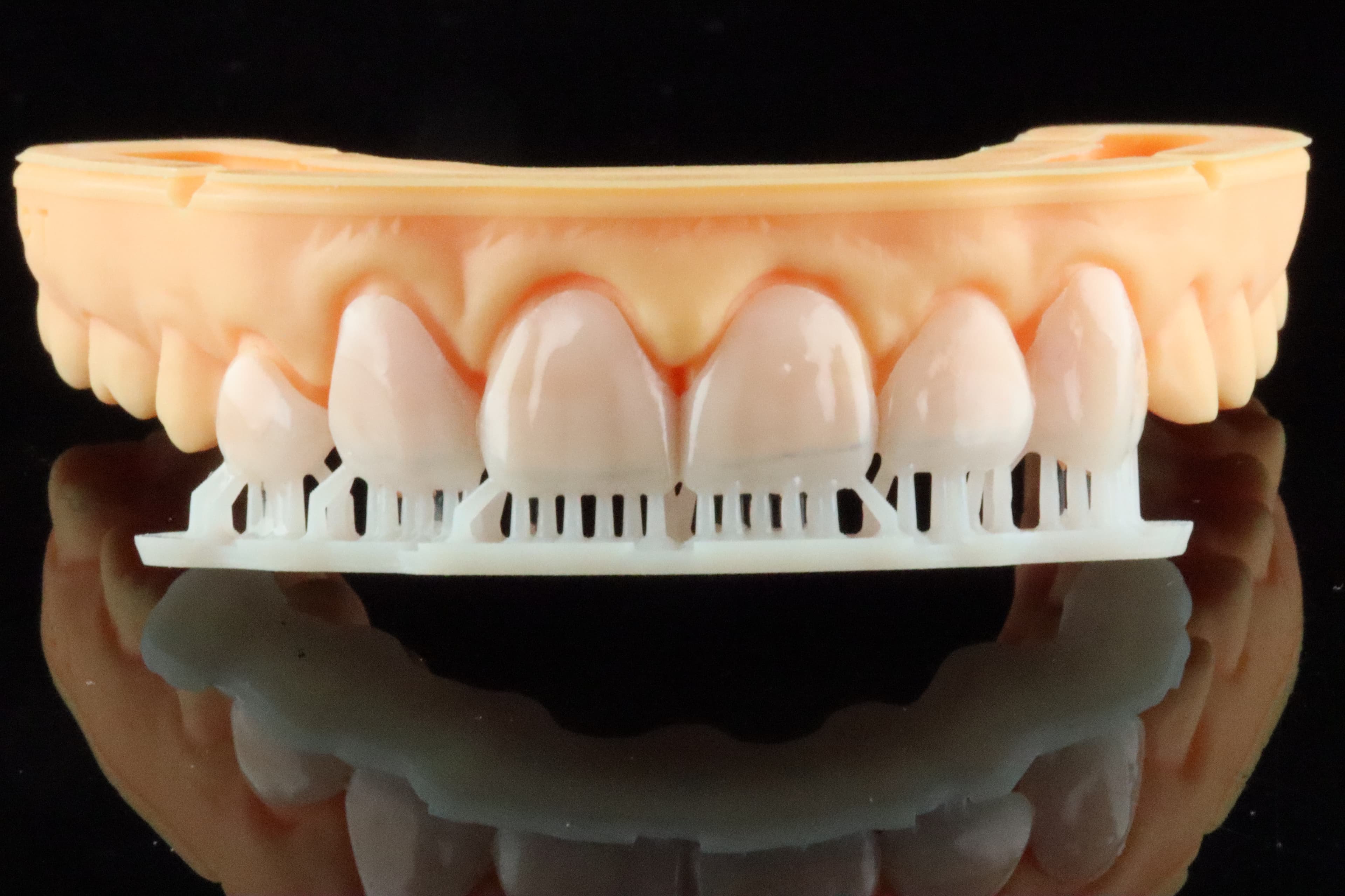 Figure 6: Trial smile and model printed on the Aris